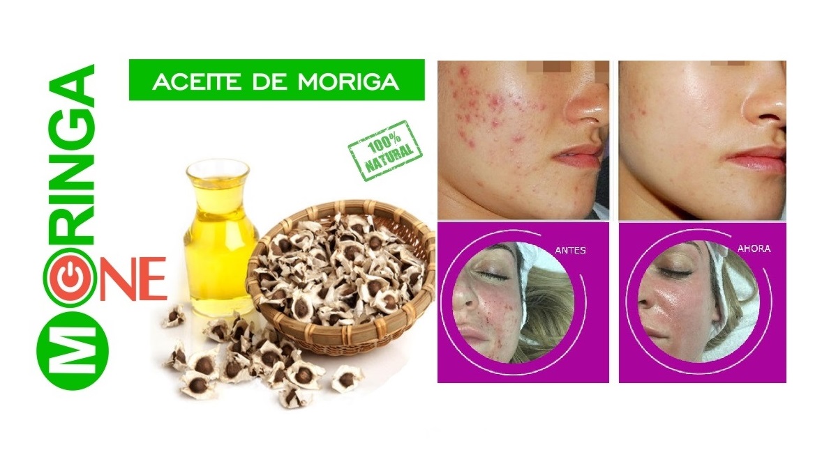 Beneficios del aceite de moringa